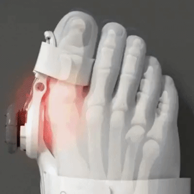 OrthoFlex™  Magic Splint